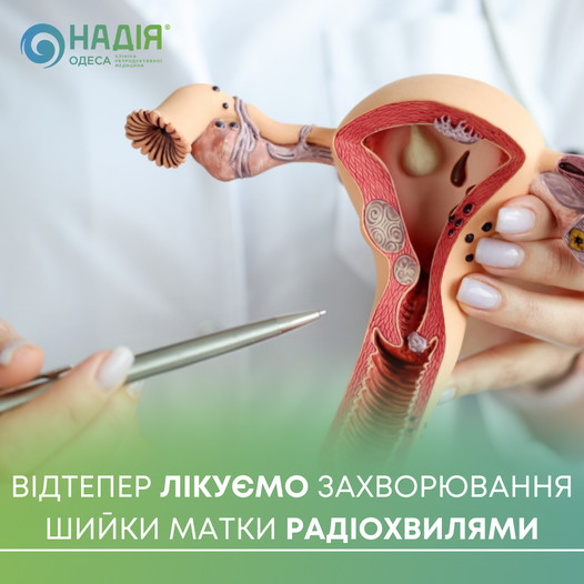 Лікування захворювань шийки матки радіохвилями